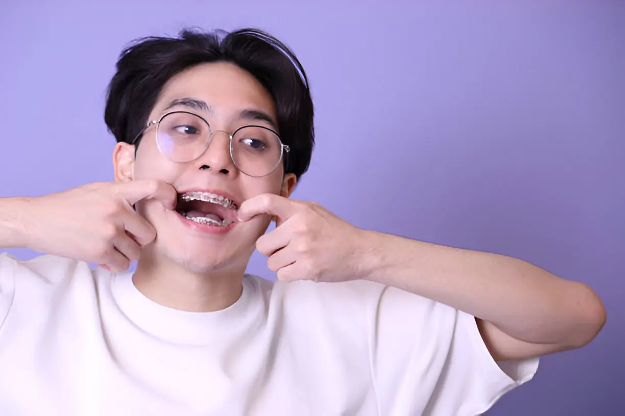 Avoid These Errors After Getting Your Braces