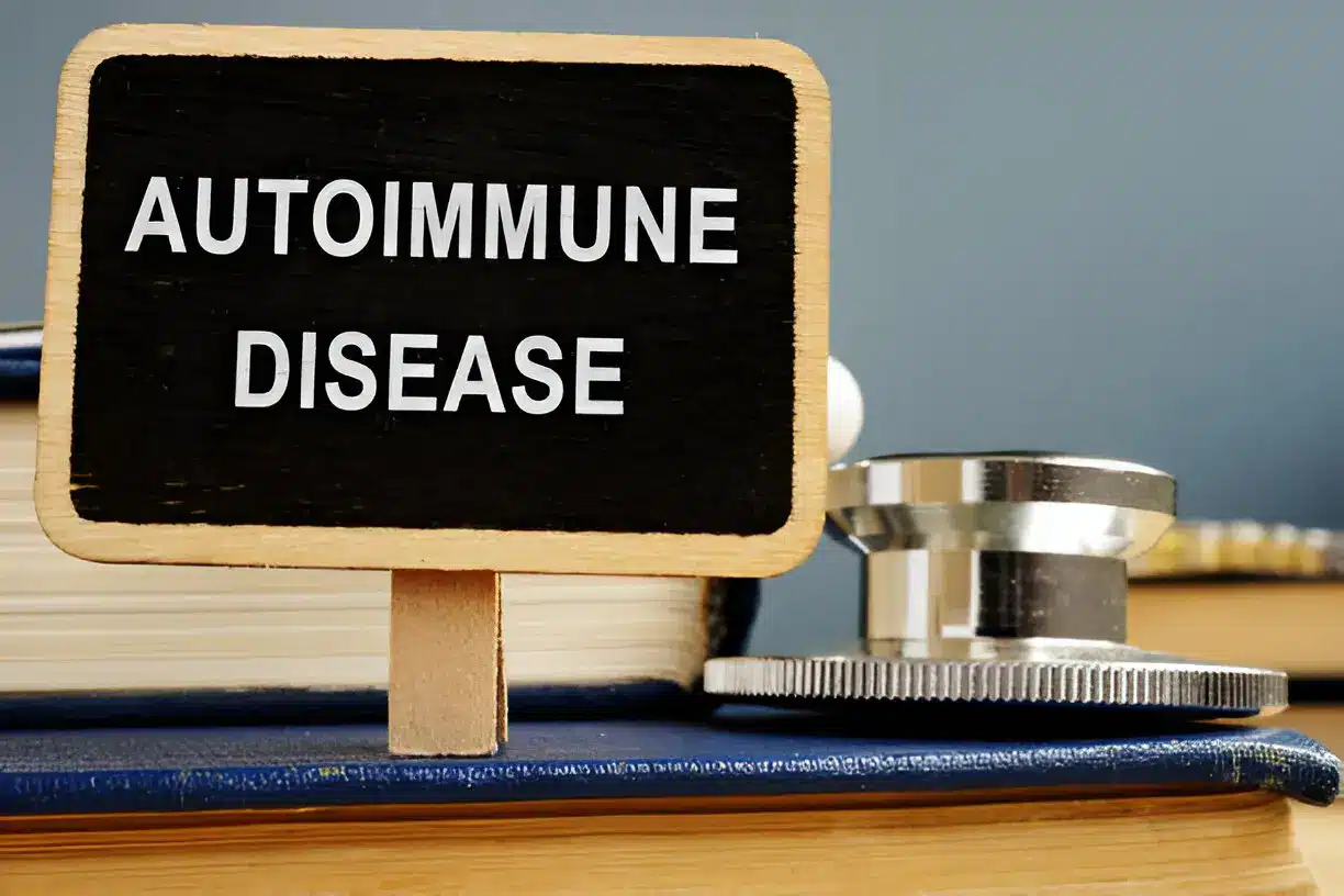 Beyond the Meds Holistic Approaches to Managing Autoimmune Disease